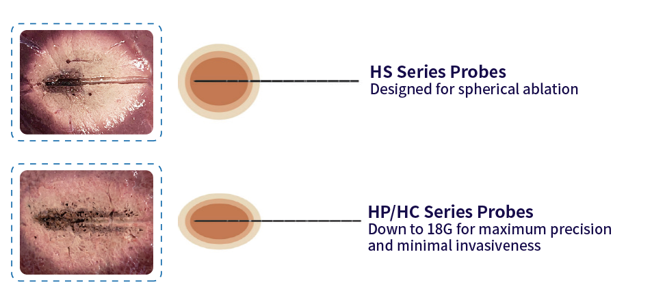 exact-sterile-microwave-ablation-probe.png